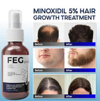 FEG Hair Growth Spray PLUS