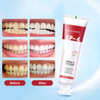 50% Off Discount Sp-4 Toothpaste (120g) Advanced Whitening Formula
