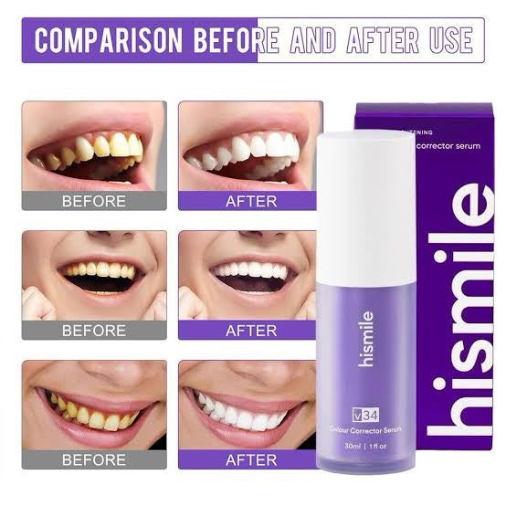 Hismile v34 Color Corrector