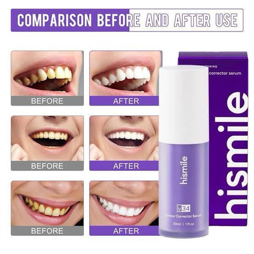 Hismile v34 Color Corrector
